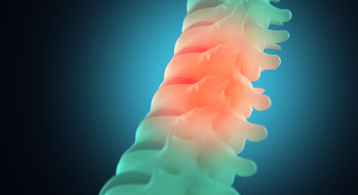 Spinal Cord and Brain Injury